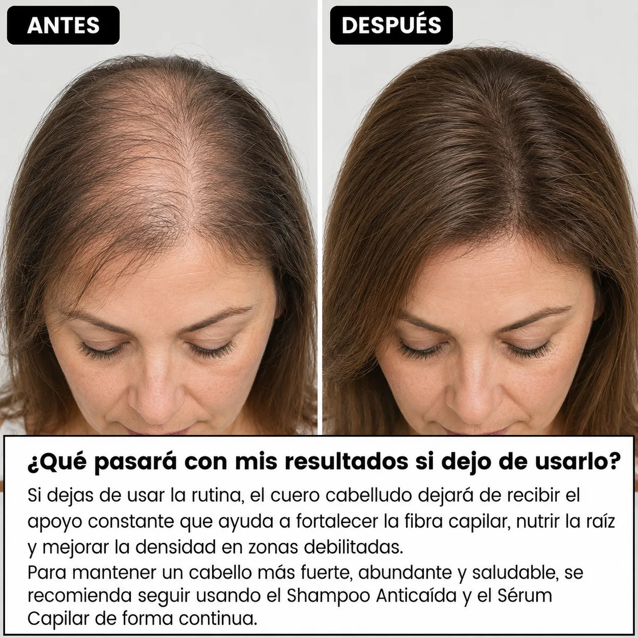 🔥 PROMOCIÓN ESPECIAL: Shampoo de Batana y Romero – Nutrición y Fuerza